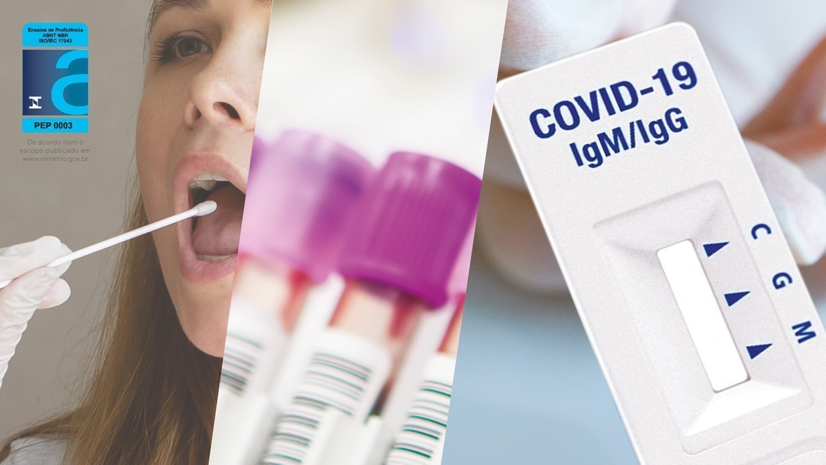 Ensaio de Proficiência: confiabilidade para o desempenho analítico dos laboratórios 3 EP SARS CoV 2