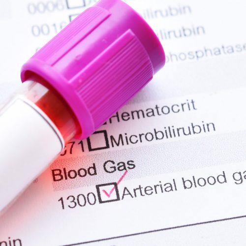 Tubo de amostra de sangue para teste de gasometria arterial